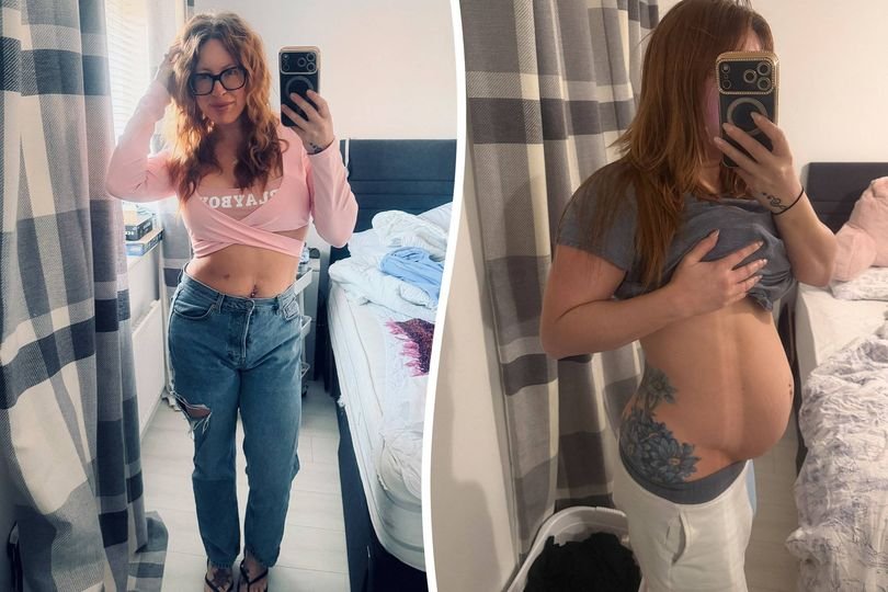 A UK mum who suffered from abdominal distension, a rare condition causing a swollen abdomen, has finally received a diagnosis after 24 years, bringing relief and closure to her family, and highlighting the importance of perseverance and accurate diagnosis in the face of uncertainty, with a focus on her journey and the impact on her behaviour and well-being