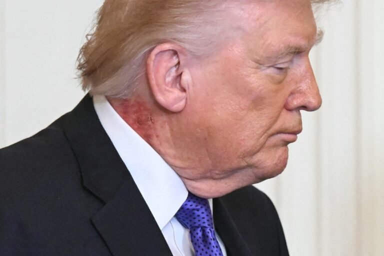 Donald Trump's health report highlights the need for weight loss, with a focus on a balanced diet and regular exercise, as well as addressing notable medical issues for overall wellbeing