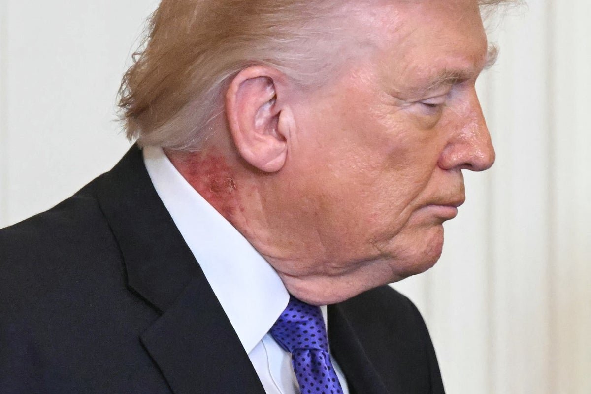 Donald Trump's health report highlights the need for weight loss, with a focus on a balanced diet and regular exercise, as well as addressing notable medical issues for overall wellbeing
