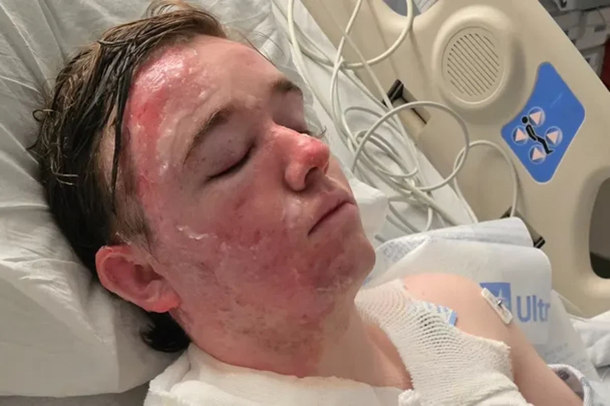 A McDonald's employee is being treated for second-degree burns after a coworker allegedly threw hot oil on them, highlighting the importance of workplace safety and the need for employers to protect their staff from harm, with a focus on preventing similar incidents in the future